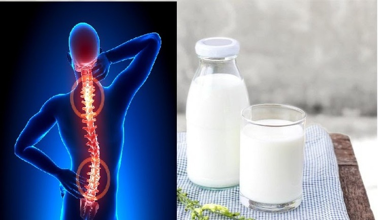 Sữa giúp hỗ trợ điều trị bệnh thoái hóa đốt sống lưng